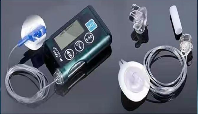 为什么用泵注射胰岛素泵——“泵”出健康_https://www.jmylbn.com_新闻资讯_第1张