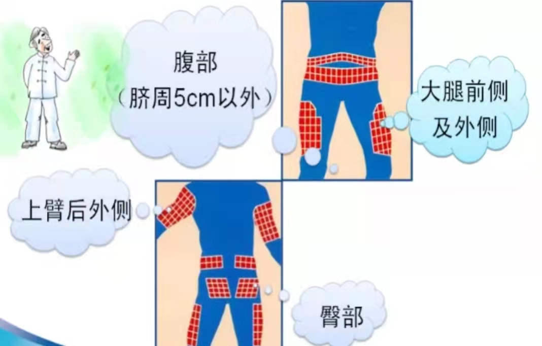 为什么用泵注射胰岛素泵——“泵”出健康_https://www.jmylbn.com_新闻资讯_第2张