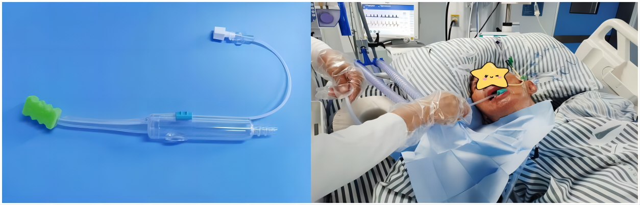 怎么给病人吸痰【健康之窗】“小而不凡”——冲吸式口护吸痰管护佑重症病人口腔健康_https://www.jmylbn.com_新闻资讯_第1张